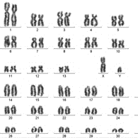 Karyotyping / Chromosome Analysis